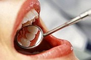 Стоматологический туризм популярен в Венгрии. // moystomatolog.com